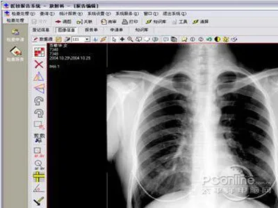 DCM文件被广泛应用于医疗行业